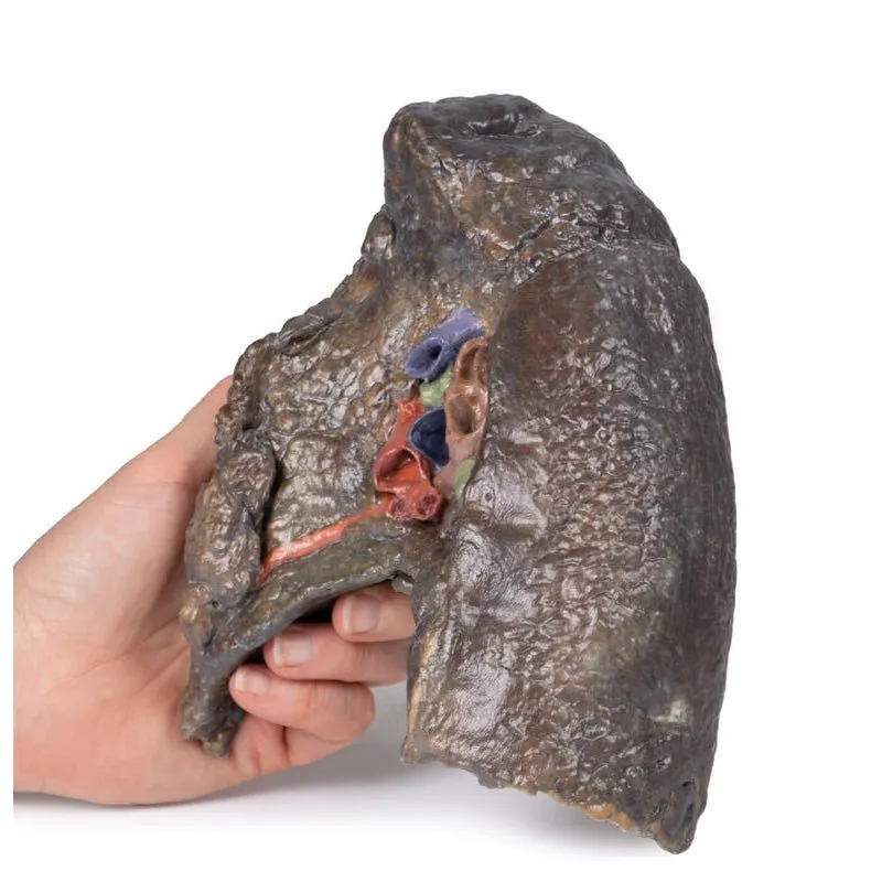 3D Printed Hilum of the Right Lung