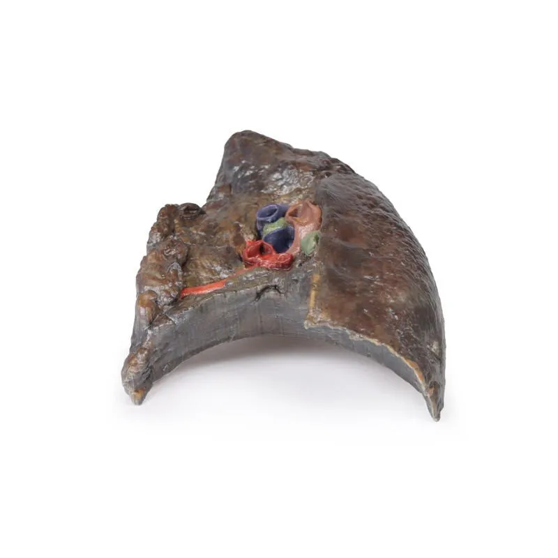 3D Printed Hilum of the Right Lung