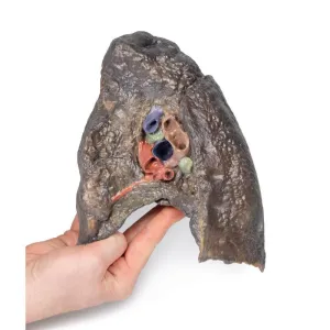 3D Printed Hilum of the Right Lung