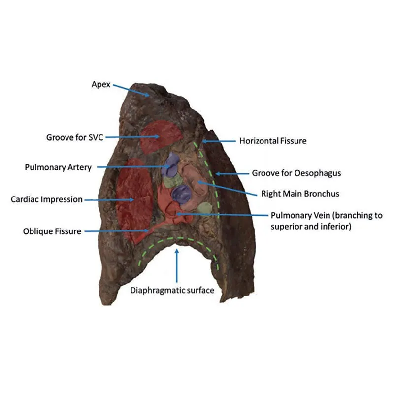 3D Printed Hilum of the Right Lung