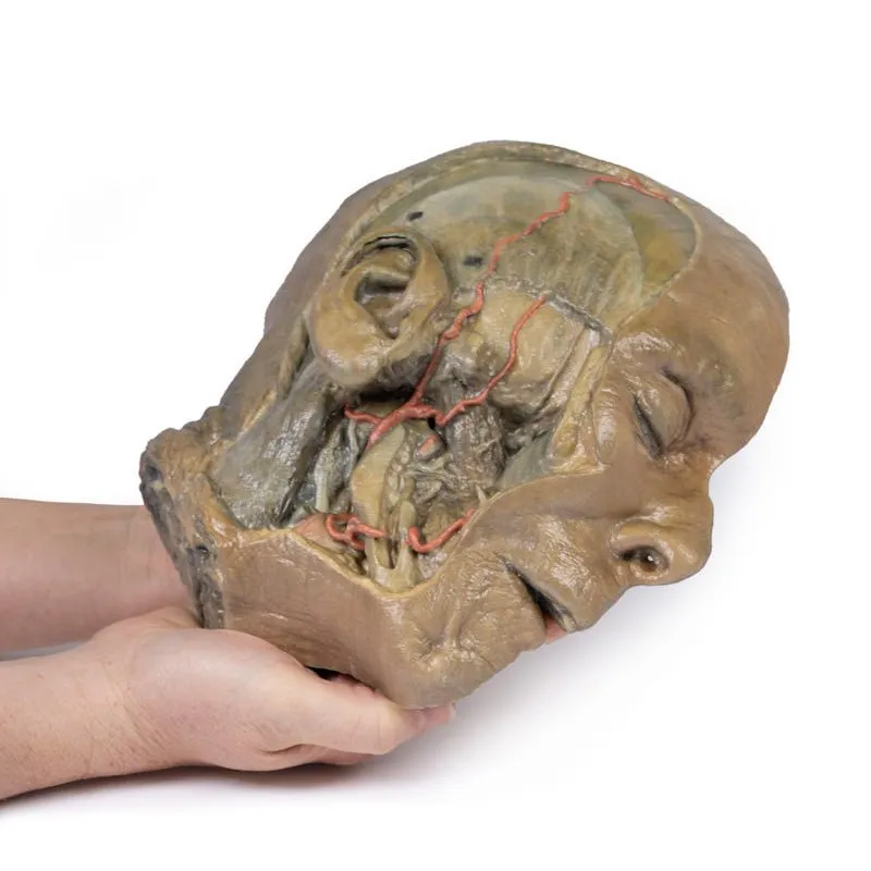 3D Printed Sagittal Section of Head with Infratemporal Fossa Dissection