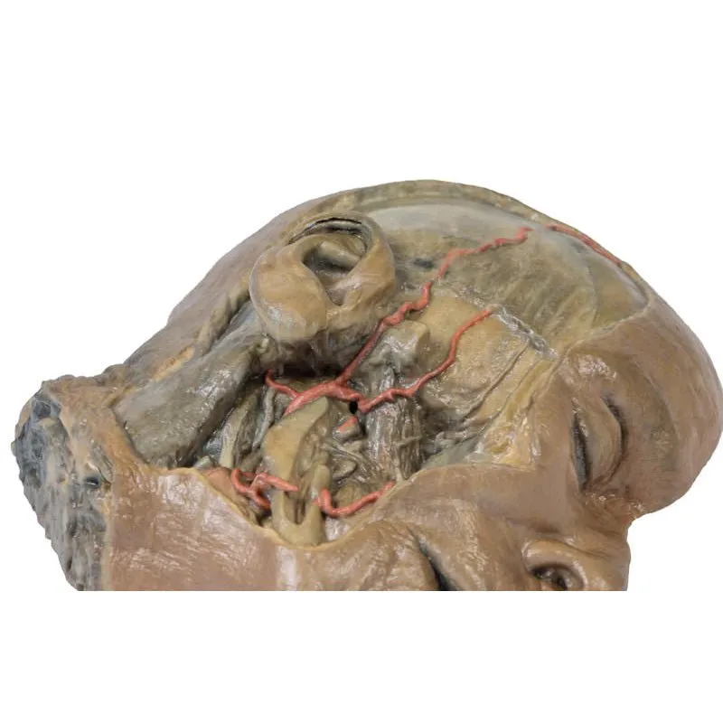 3D Printed Sagittal Section of Head with Infratemporal Fossa Dissection
