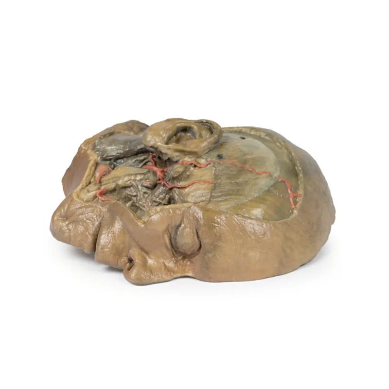 3D Printed Sagittal Section of Head with Infratemporal Fossa Dissection