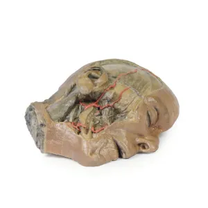3D Printed Sagittal Section of Head with Infratemporal Fossa Dissection