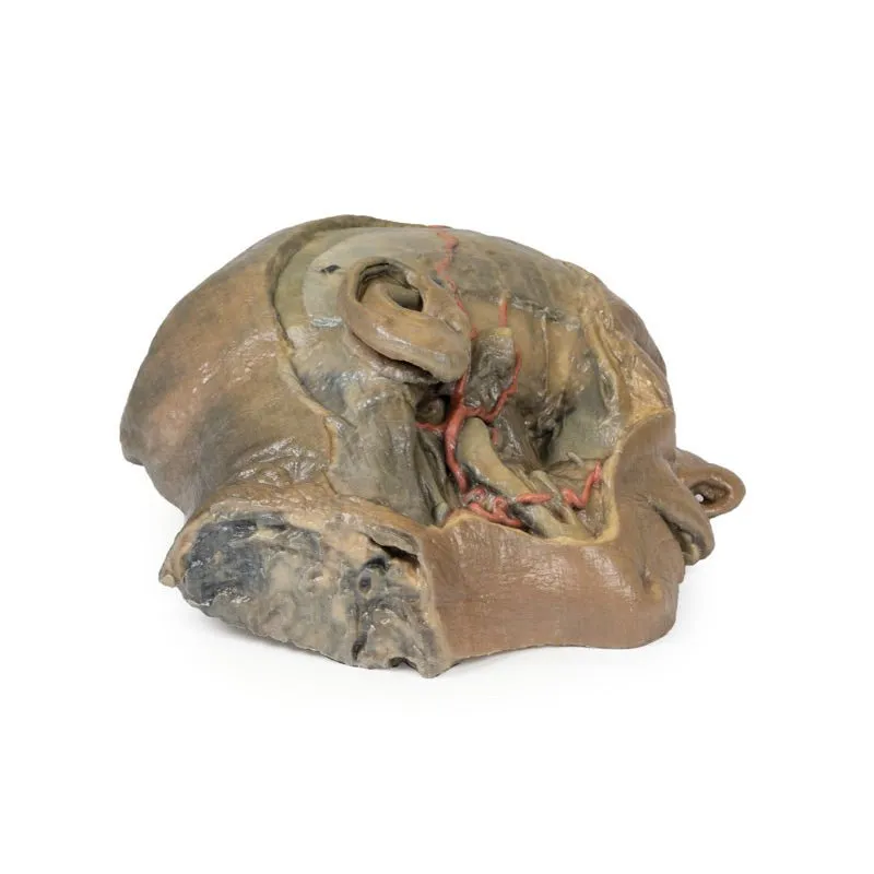 3D Printed Sagittal Section of Head with Infratemporal Fossa Dissection