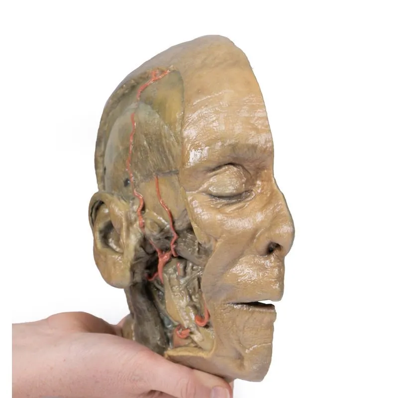 3D Printed Sagittal Section of Head with Infratemporal Fossa Dissection