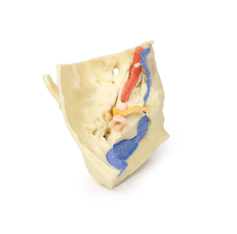 3D Printed Temporal Bone Model, Set of 3