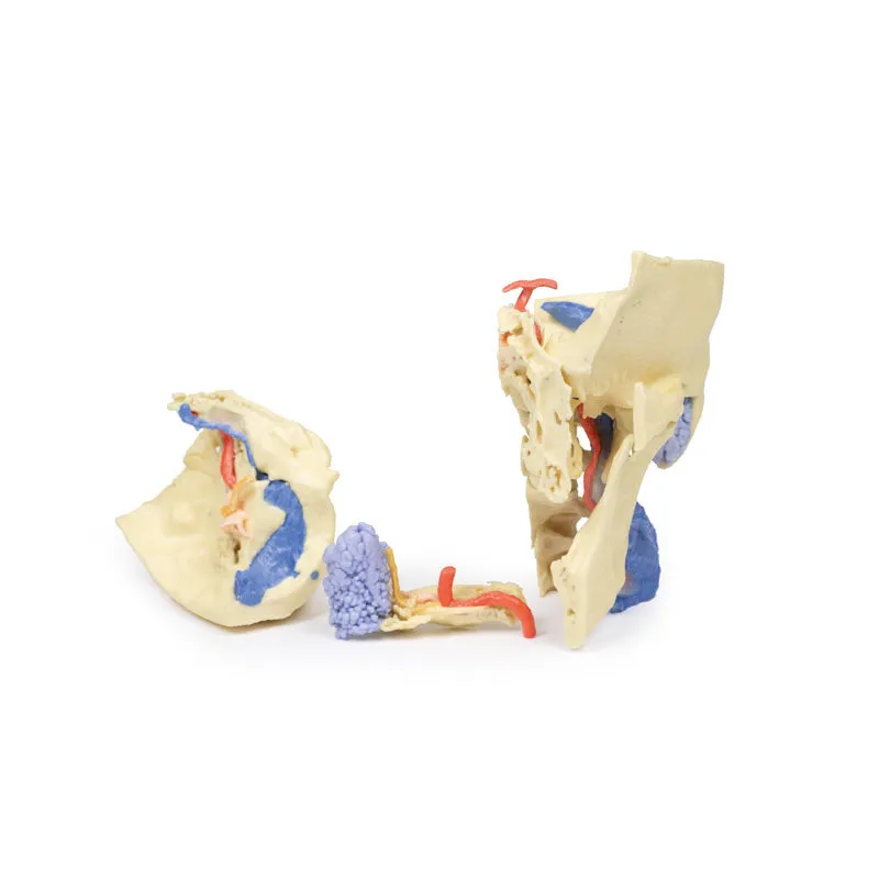 3D Printed Temporal Bone Model, Set of 3