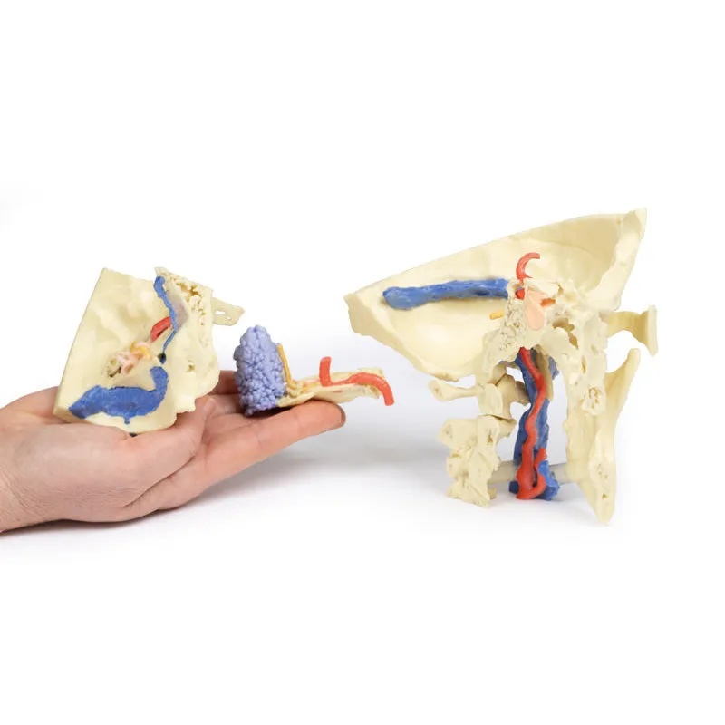 3D Printed Temporal Bone Model, Set of 3